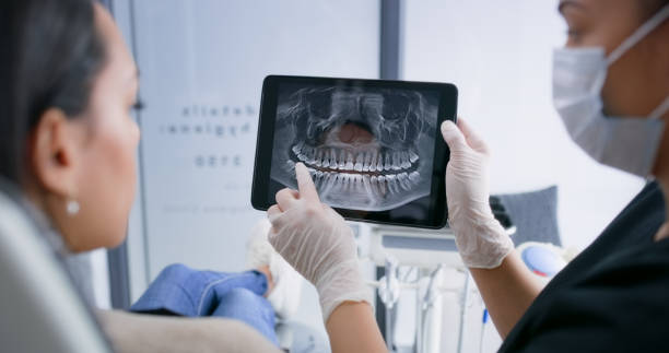 Licensed Root Canal Treatment service in Chico, TX - Dentist Open Now