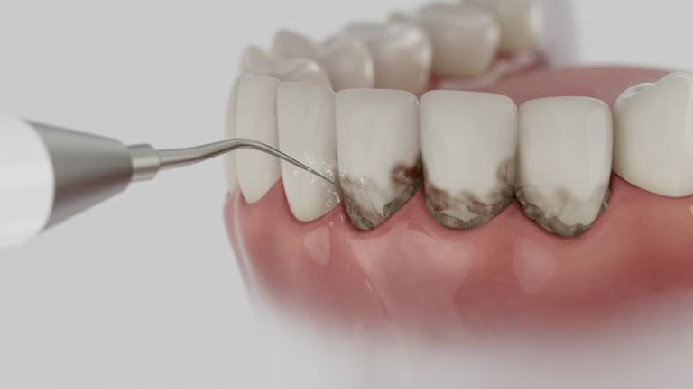 Trusted Root Canal Treatment service in Chico, TX - Dentist Open Now